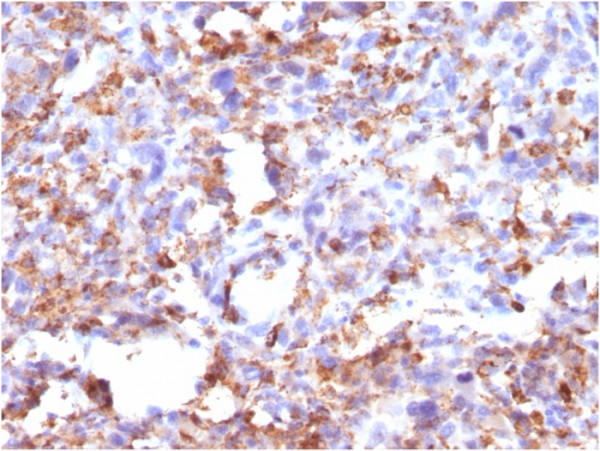 Anti-CD68 (Macrophage Marker), clone CD68/G2