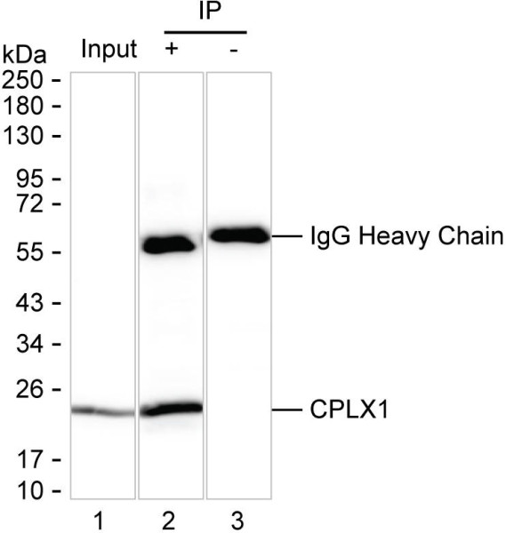 Anti-CPLX1