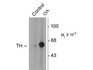 Anti-phospho-Tyrosine Hydroxylase (Ser31)