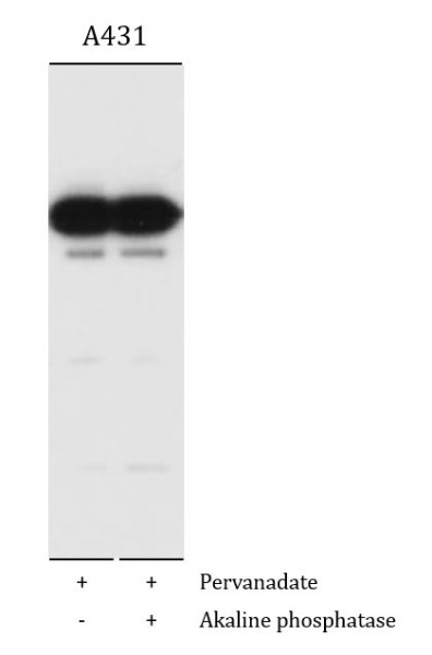 Anti-E Cadherin, clone M168