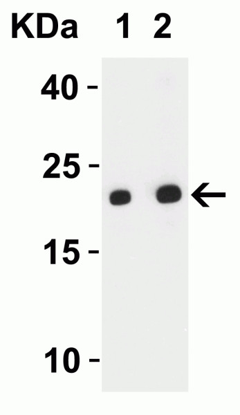 Anti-SARS-CoV-2 ORF3b
