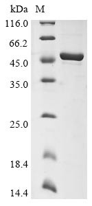 Nucleoprotein (N), human coronavirus 229E, recombinant