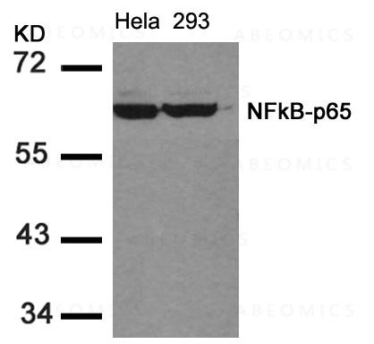 Anti-NFkB-p65 (Ab-536)