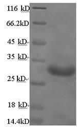 Pertussis toxin subunit 1 (ptxA), Bordetella pertussis, recombinant