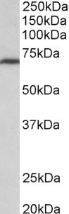 Anti-MTHFR