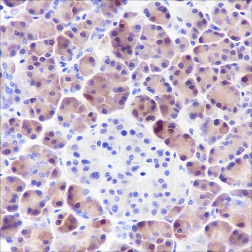 Anti-Recombinant SPINK1, clone A366