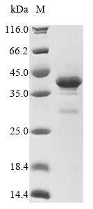 T-cell leukemia virus 1 HTLV-1 basic zipper factor (HBZ), human, recombinant