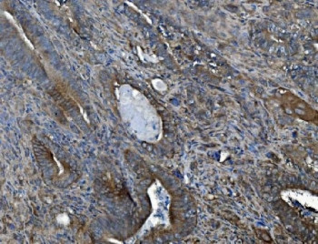 Anti-ACVRL1 / ALK1