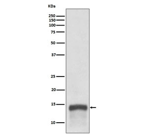 Anti-S100A9 / MRP14 / Calgranulin B / Calprotectin L1H, clone AOOH-19