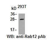 Anti-Rab12