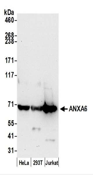 Anti-ANXA6