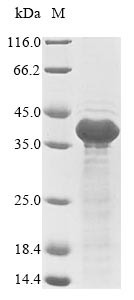 Latent membrane protein 1 (LMP1), partial, Epstein-Barr virus, recombinant