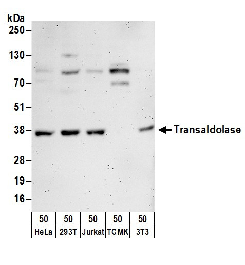 Anti-Transaldolase