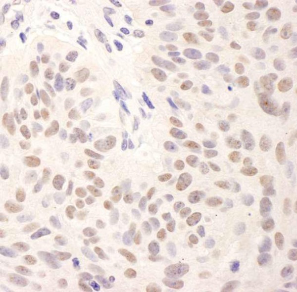 Anti-BMI1 (IHC)