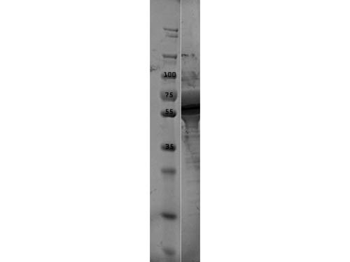 ErpN/OspE Control Protein