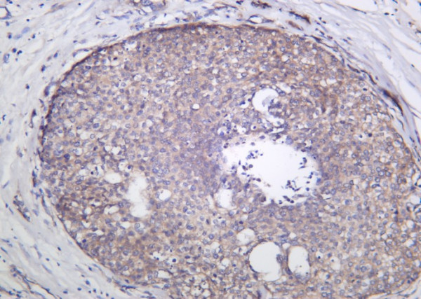 Anti-Recombinant GCN2, clone 2D10
