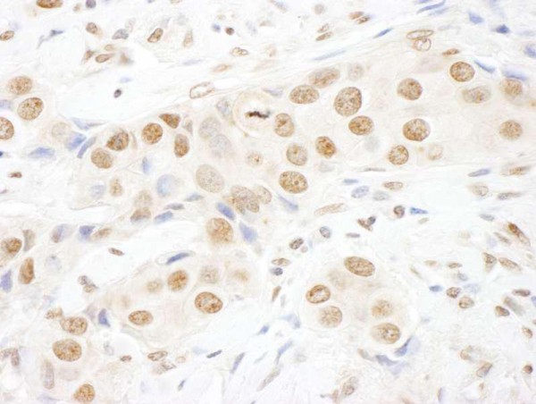 Anti-TOPORS (IHC)