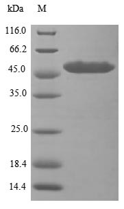 ATP-dependent RNA helicase DHX33 (DHX33), partial, human, recombinant