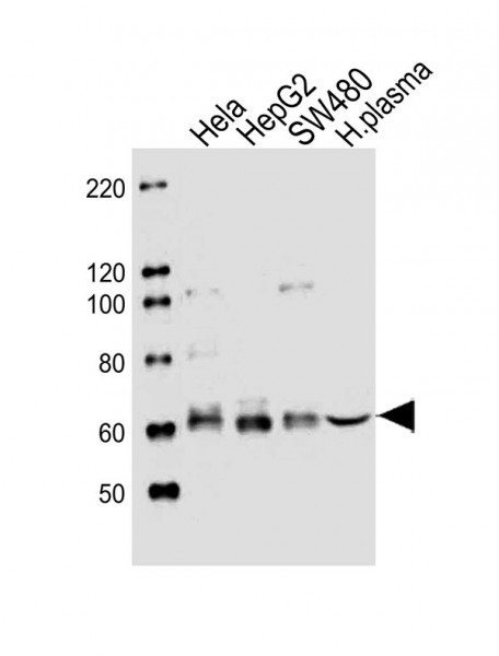 Anti-PCSK9