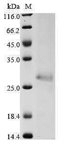 E3 ubiquitin-protein ligase ZNRF3 (ZNRF3), partial, human, recombinant