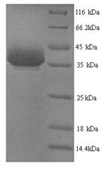 Y-box-binding protein 1 (Ybx1), mouse, recombinant