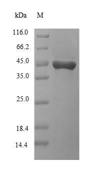 Killer cell immunoglobulin-like receptor 2DS3 (KIR2DS3), partial, human, recombinant
