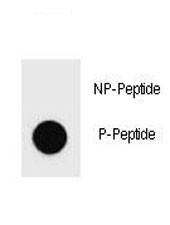 Anti-phospho-PARP1 (Ser177)