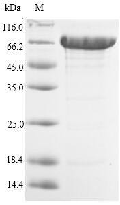 Acetyl-coenzyme A synthetase 2-like, mitochondrial (ACSS1), human, recombinant