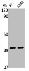 Anti-ATP6V0D1
