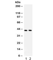 Anti-STING / TMEM173