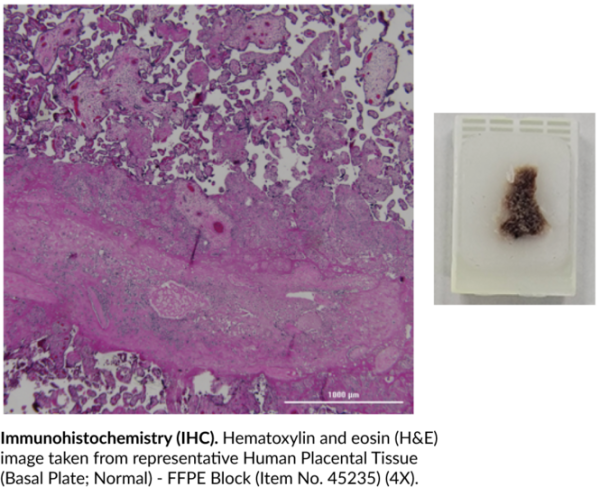 Human Placental Tissue (Basal Plate, Normal) - FFPE Block