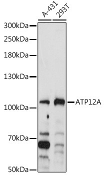 Anti-ATP12A