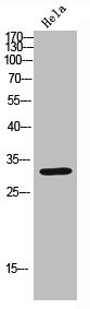 Anti-CDK6