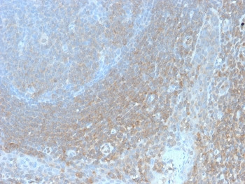 Anti-Bcl10, clone BL10/2988R