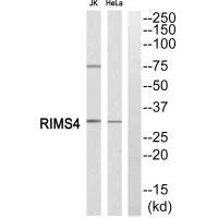 Anti-RIMS4