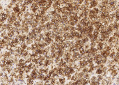 Anti-Alkaline Phosphatase/ALPL Monoclonal Recombinant Antibody