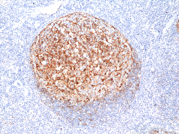 Anti-Clusterin (human), Rabbit Monoclonal (RM437)