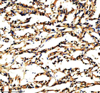 Anti-PXDN / Peroxidasin