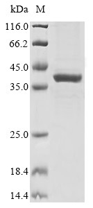 Glutaminyl-peptide cyclotransferase (QPCT), human, recombinant