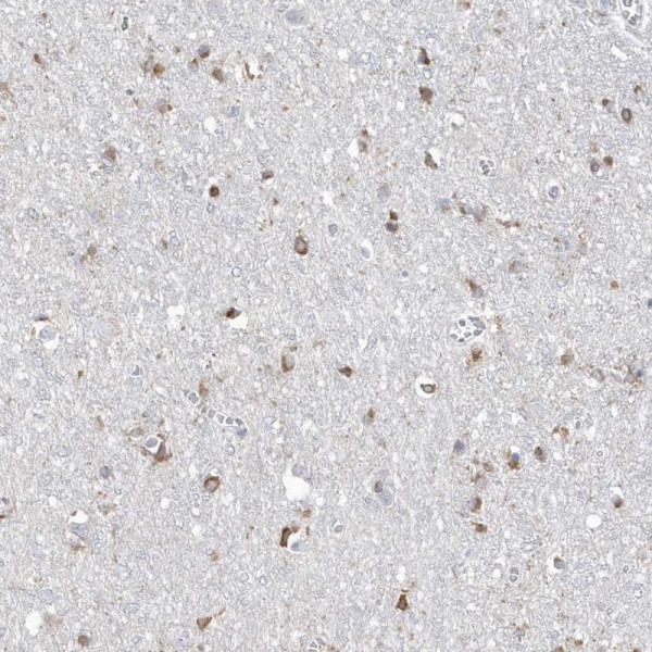 Anti-TMEM132B