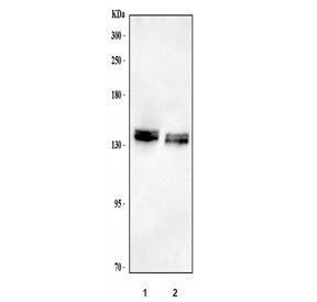 Anti-Neurocan / NCAN