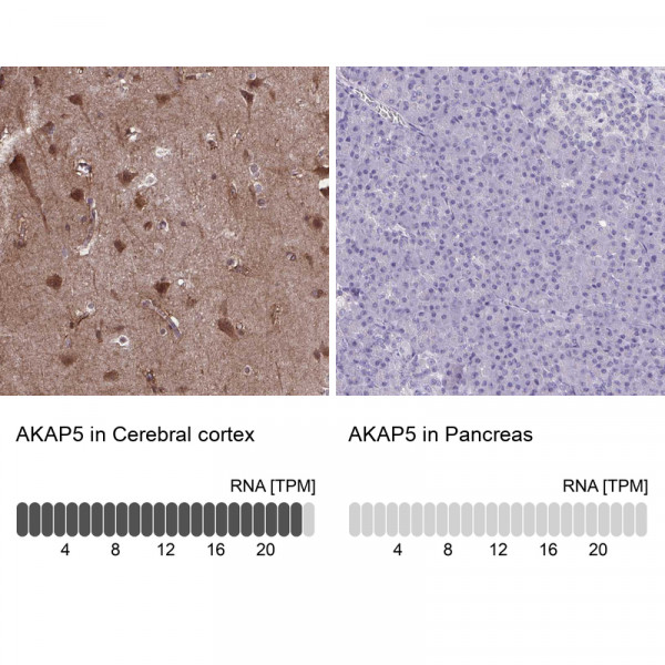 Anti-AKAP5