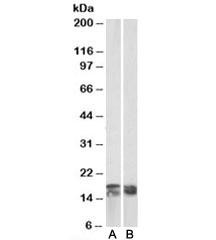 Anti-CD3 zeta