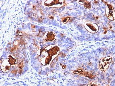 Anti-Carcinoembryonic Antigen (CEA) / CD66(Clone: C66/1260)