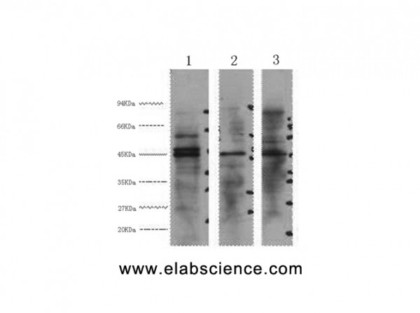 Anti-ENO2, clone 2K3