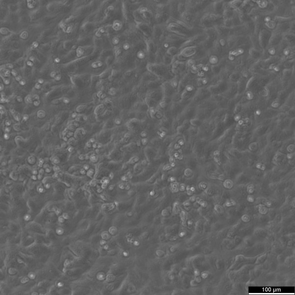 NCI-H157 Cells