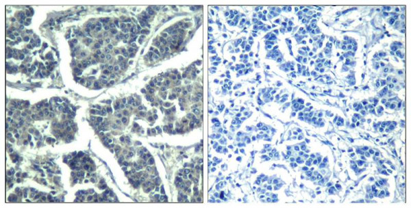 Anti-phospho-PLC gamma2 (Tyr1217)