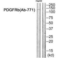 Anti-PDGFRB (Ab-771)