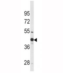 Anti-WNT4