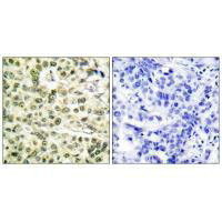 Anti-PCNA